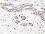 Myosin, Smooth Muscle Heavy Chain(MYH11/923), 1mg/mL
