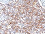 Ep-CAM / CD326(Cocktail PAN-EpCAM), 0.2mg/mL