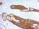 Cytokeratin, HMW(KRTH/1076), 0.2mg/mL 1 BNUB1076-0-1
