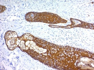 BNUB1076-0-1 BNUB1076 0 1- Immunomart