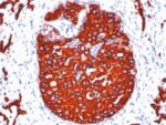 Cytokeratin, pan(KRTL/1077 + KRTH/1076), CF740 conjugate, 0.1mg/mL 1 BNUB1100-0-1