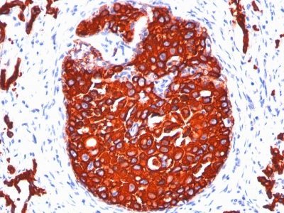 BNUB1100-0-1 BNUB1100 0 1- Immunomart