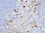 MCAM / MUC18 / Mucin 18 / CD146(MCAM/1101), Biotin conjugate, 0.1mg/mL