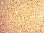 Arginase 1 (Hepatocellular Carcinoma Marker) (ARG1/1125) , CF405S conjugate, 0.1mg/mL 1 BNUB1125