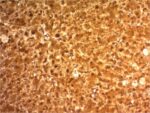 Arginase 1 (Hepatocellular Carcinoma Marker) (ARG1/1126) , 0.2mg/mL