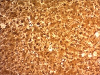 Arginase 1 (Hepatocellular Carcinoma Marker) (ARG1/1126) , 0.2mg/mL