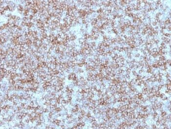 MHC II (HLA-DP) (beta chain)(Bra-14), CF647 conjugate, 0.1mg/mL