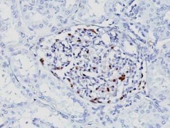 WT1 (Wilm's Tumor 1)(WT1/857 + 6F-H2), Biotin conjugate, 0.1mg/mL