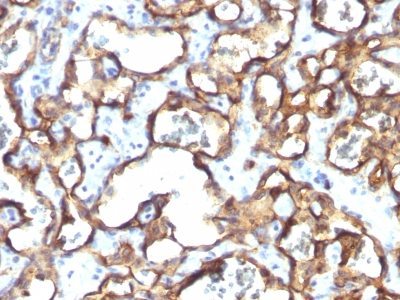 BNUB1171-0-1 BNUB1171 0 1- Immunomart