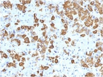 Growth Hormone (Pituitary Marker) (GH/1371), 0.2mg/mL