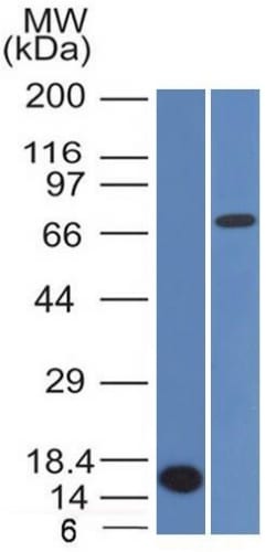 Bcl-6 (Follicular Lymphoma Marker) (BCL6/1475), CF594 conjugate, 0.1mg/mL