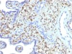 S100A4 (Marker of Tumor Metastasis) (S100A4/1481), CF640R conjugate, 0.1mg/mL 1 BNUB1481