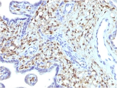 BNUB1481 BNUB1481- Immunomart