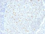 Bcl-6 (Follicular Lymphoma Marker) (BCL6/1526), Biotin conjugate, 0.1mg/mL