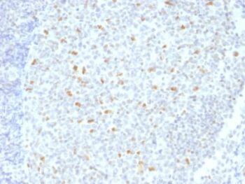 Bcl-6 (Follicular Lymphoma Marker) (BCL6/1526), Biotin conjugate, 0.1mg/mL