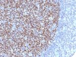 Bcl-6 (Follicular Lymphoma Marker) (BCL6/1527), CF594 conjugate, 0.1mg/mL