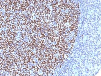 Bcl-6 (Follicular Lymphoma Marker) (BCL6/1527), CF594 conjugate, 0.1mg/mL