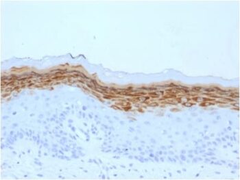 Filaggrin (Keratinocyte Differentiation Marker) (FLG/1561), CF594 conjugate, 0.1mg/mL