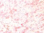 Tyrosinase-Related Protein-1 (TYRP-1) (Melanoma Marker) (TYRP1/1564R), CF488A conjugate, 0.1mg/mL 1 BNUB1564-0