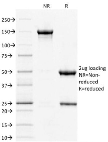 STAT3 / Signal Transducer and Activator of Transcription 3 (PCRP-STAT3-2F12), CF640R conjugate, 0.1mg/mL