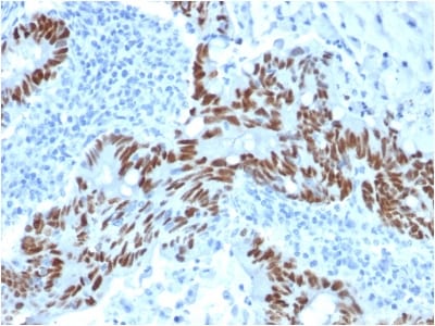 BNUB1925- Immunomart