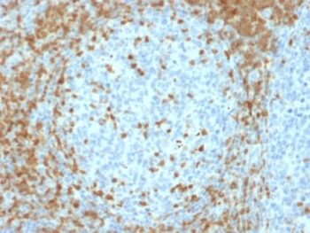 ZAP70 (Chronic Lymphocytic Leukemia Marker) (ZAP70/2035), CF740 conjugate, 0.1mg/mL