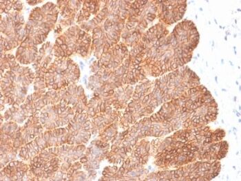 EpCAM / CD326 (Epithelial Marker) (EGP40/2041R), Biotin conjugate, 0.1mg/mL