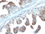 PTEN (Tumor Suppressor Oncoprotein) (PTEN/2110), CF640R conjugate, 0.1mg/mL