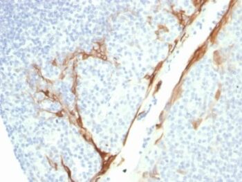 Cytokeratin 16 (KRT16) (Suprabasal Keratinocyte Marker) (rKRT16/1714), CF740 conjugate, 0.1mg/mL