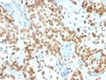 Emerin (Papillary Thyroid Carcinoma and EDMD Marker) (EMD/2167), 1mg/mL