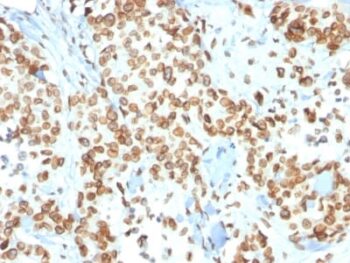 Emerin (Papillary Thyroid Carcinoma and EDMD Marker) (EMD/2167), 1mg/mL