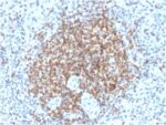 Bcl-2 (Apoptosis & Follicular Lymphoma Marker) (BCL2/2210R), CF594 conjugate, 0.1mg/mL