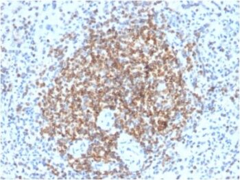 Bcl-2 (Apoptosis & Follicular Lymphoma Marker) (BCL2/2210R), CF594 conjugate, 0.1mg/mL