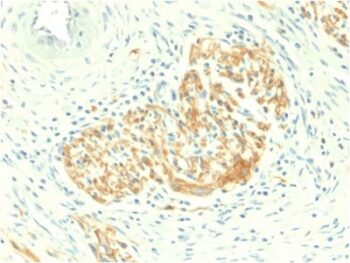 CD56 / NCAM1 / NKH1 (Neuronal Cell Marker) (NCAM1/2217R), CF740 conjugate, 0.1mg/mL