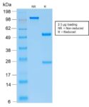 Parathyroid Hormone (PTH) (N-Terminal) (PTH/2295R), 0.2mg/mL