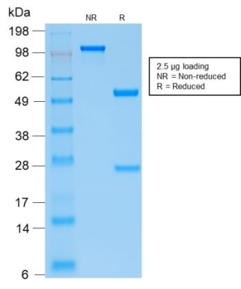 Parathyroid Hormone (PTH) (N-Terminal) (PTH/2295R), 0.2mg/mL