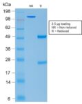 ACTH (Adrenocorticotrophic Hormone) (Pituitary Marker) (rCLIP/1407), CF594 conjugate, 0.1mg/mL