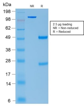 ACTH (Adrenocorticotrophic Hormone) (Pituitary Marker) (rCLIP/1407), CF594 conjugate, 0.1mg/mL