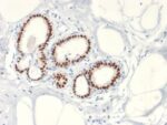 Estrogen Receptor, alpha (Marker of Estrogen Dependence) (ESR1/2299R), CF594 conjugate, 0.1mg/mL