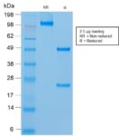MUC18 / CD146 / MCAM (Melanoma Cell Adhesion Molecule) (rMUC18/1130), CF640R conjugate, 0.1mg/mL