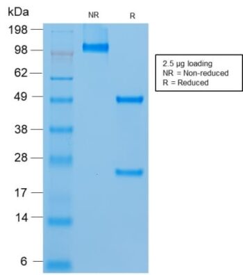 MUC18 / CD146 / MCAM (Melanoma Cell Adhesion Molecule) (rMUC18/1130), CF640R conjugate, 0.1mg/mL
