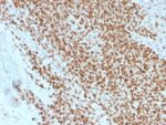 NKX2.2 (Neuroendocrine & Ewing s Sarcoma Marker) (rNX2/1523), CF740 conjugate, 0.1mg/mL