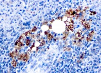 TRAcP (Tartrate-Resistant Acid Phosphatase) (Hairy Cell Leukemia Marker) (rACP5/1070), CF640R conjugate, 0.1mg/mL