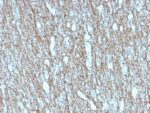 Neurofilament (NF-H) (Neuronal Marker) (rNF421), 1mg/mL