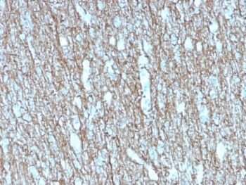 Neurofilament (NF-H) (Neuronal Marker) (rNF421), 1mg/mL