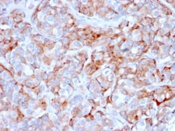 CD269 / TNFRSF17 / BCMA (B-Cell Maturation Protein) (BCMA/2366), 1mg/mL