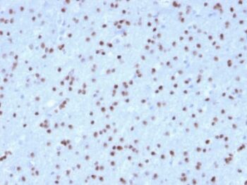 OLIG2 (Marker of Glial Brain Tumors) (OLIG2/2400), 0.2mg/mL