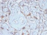 TIMP2 (Tissue Inhibitor of Metalloproteinase 2) (TIMP2/2488R), CF594 conjugate, 0.1mg/mL