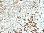 NGF-Receptor (p75) / CD271 (Soft Tissue Tumor Marker) (NGFR/2550R), CF594 conjugate, 0.1mg/mL