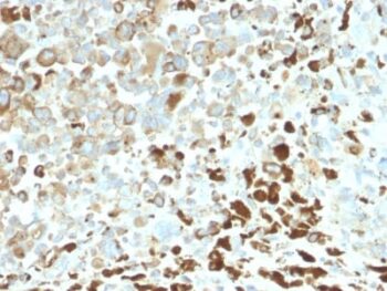 NGF-Receptor (p75) / CD271 (Soft Tissue Tumor Marker) (NGFR/2550R), CF594 conjugate, 0.1mg/mL